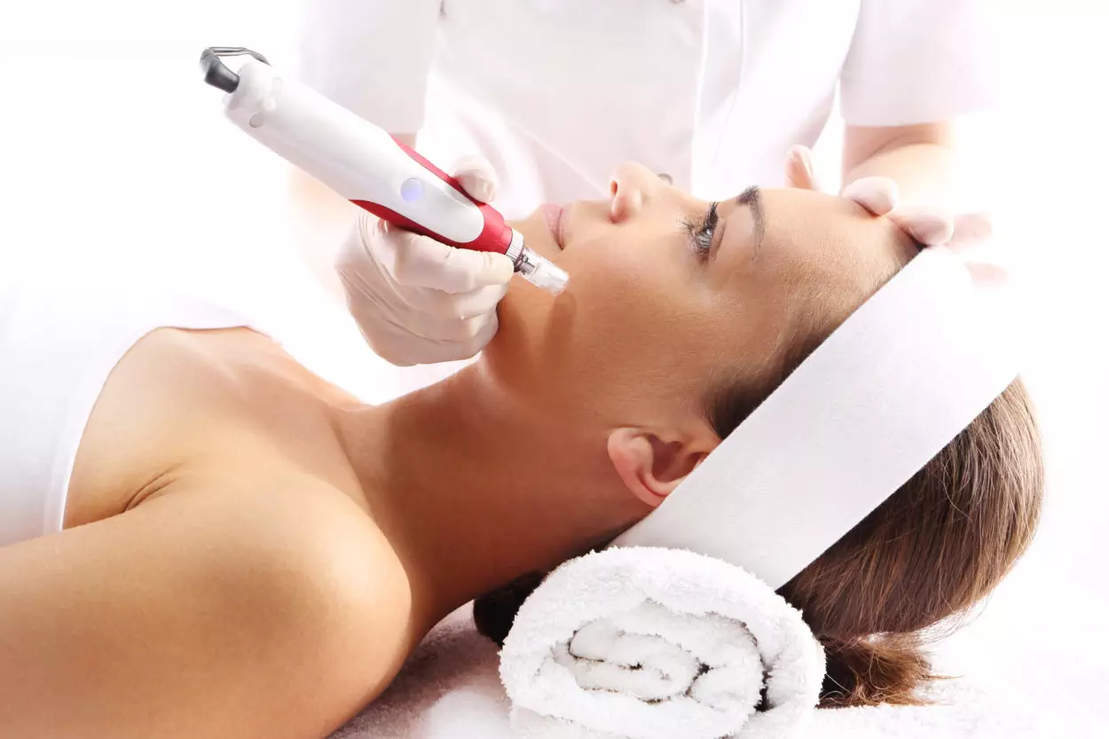 What Does Microneedling Do?