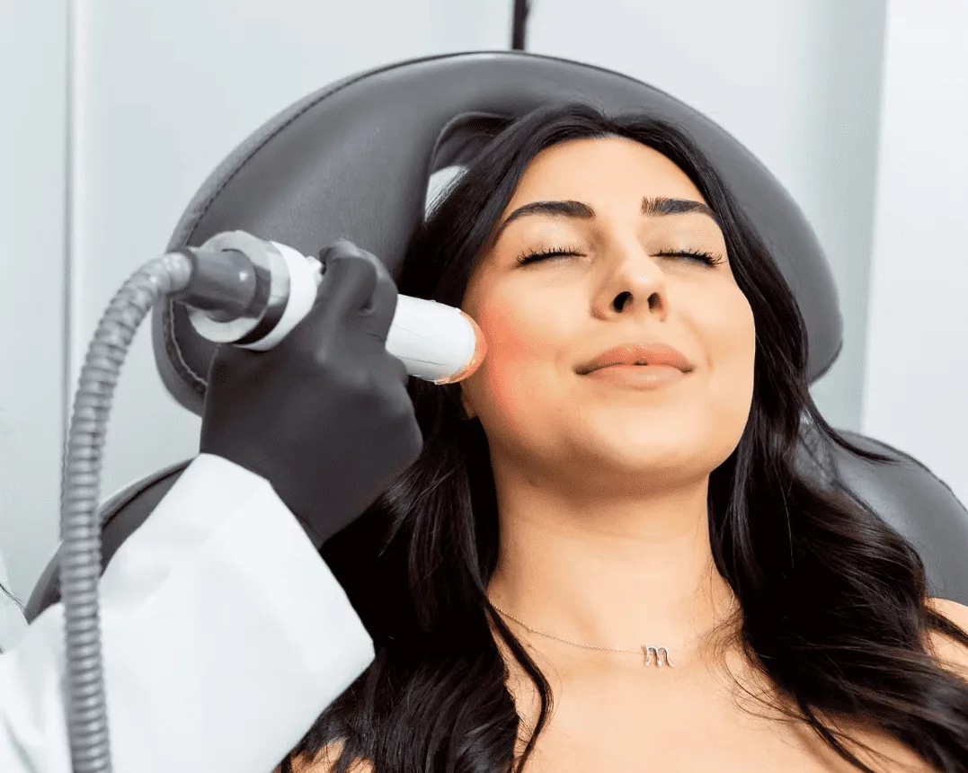 Radio Frequency Microneedling