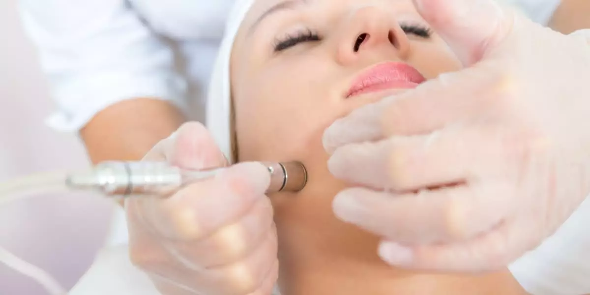 microdermabrasion