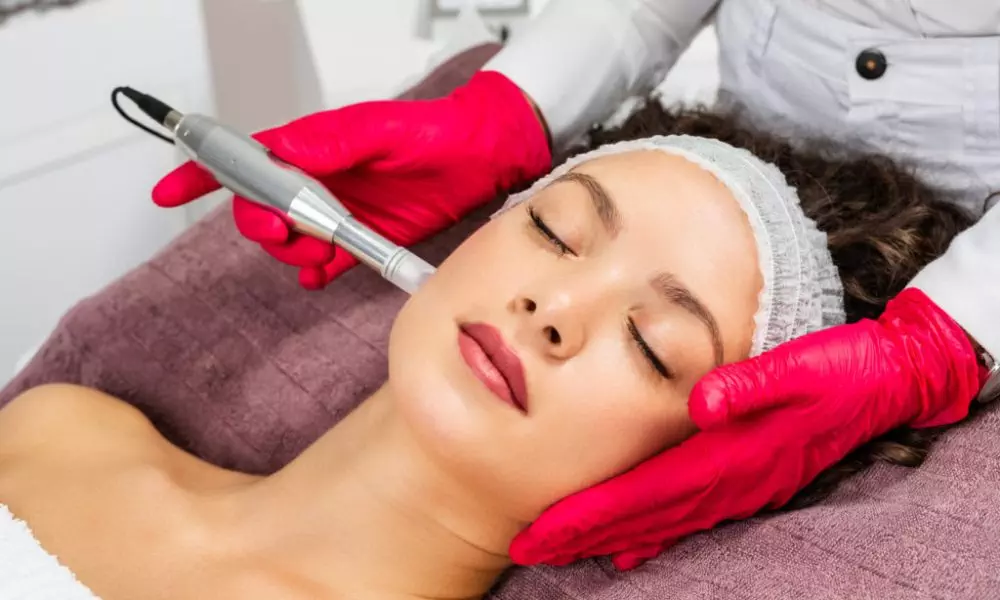 Microneedling